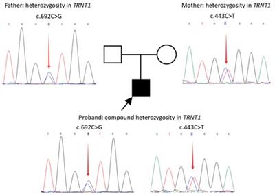 Case report: Muscle involvement in a Chinese patient with TRNT1-related disorder